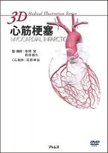 3d Medical Illustration Series 心筋梗塞 Dvd Rom 医学 科学領域の書籍とソフトショップ アトムス ウェブショップ